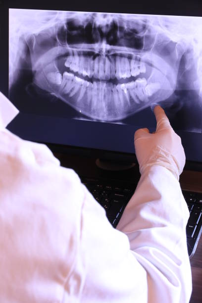 Best Knocked-Out Tooth (Avulsed Tooth) Treatment in Neuse Forest, NC